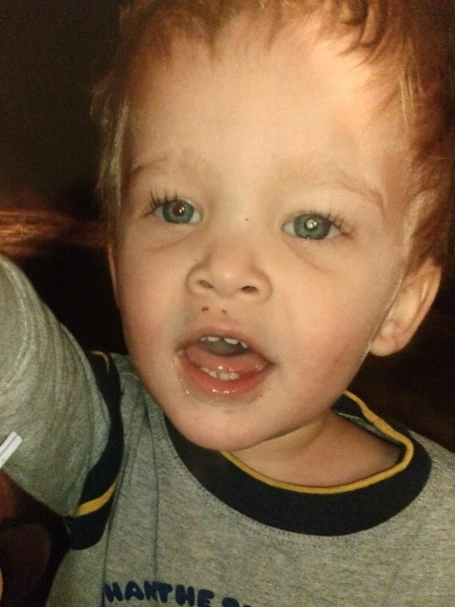 Spread the word on this family's efforts to raise $ for their son's eye <a href="/FostersDailyDem/">Fosters Daily Democrat</a> fosters.com/article/201601…