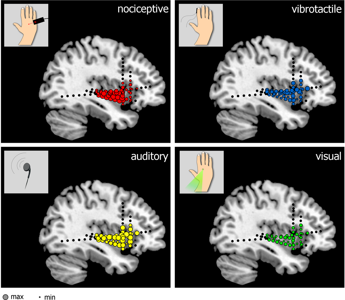 Nociceptive LFPs Recorded
from the Insula Are Not Specific for
Nociception <a href="/PLOSBiology/">PLOS Biology</a>! journals.plos.org/plosbiology/ar…