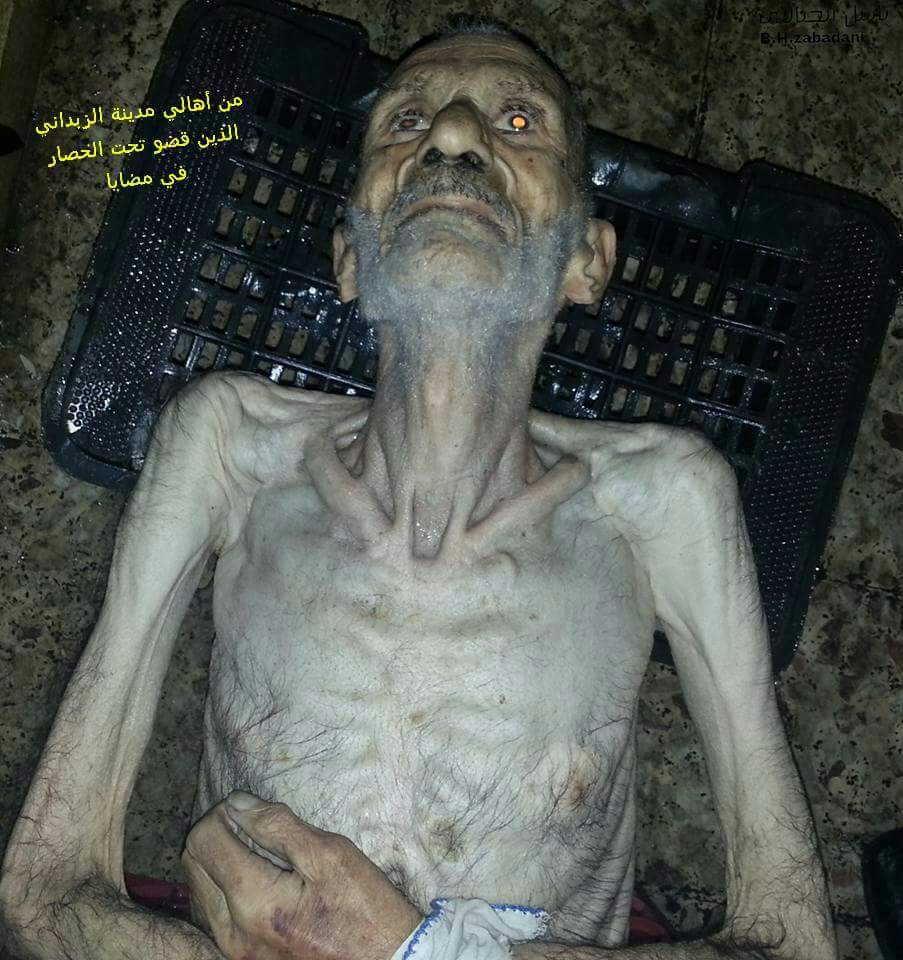 في حصارنا الاول على الغوطة اكلنا طعام الابقار من اعلاف وشعير لكن اهلنا في مضايا حتى الاعلاف لم تتوفر لديهم
الموت جوع