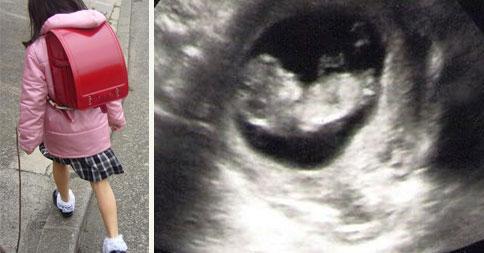 ゆーし 衝撃 小学生の女の子 お腹が痛い 吐き気がする その後 検査の結果妊娠5ヶ月であることが判明 気になる相手はまさかの D T Co 9cigajxokv これはあかん T Co 6welytimxt Twitter ゆーし 衝撃 小学生の女の子 お腹が痛い 吐き気がする その後 検査の結果妊娠5ヶ月であることが判明 気になる相手はまさかの D T Co 9cigajxokv これはあかん T Co 6welytimxt Twitter