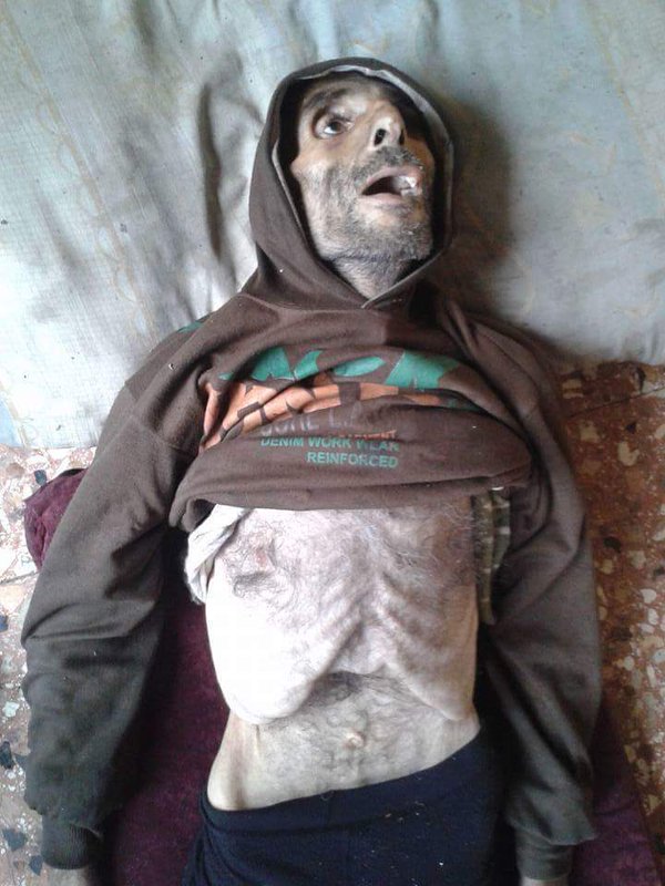 Raqqa_SL's tweet photo. Madaya's residents, people like us, starving to death. They die cursing world's inaction #Madaya #Syria #SaveMadaya https://t.co/EAFhevZ0Qs