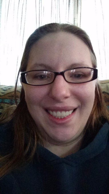 My new teeth https://t.co/PI24j0n3MI<a href="/tag/nationalbestfriendsday"class="tags"><span>#nationalbestfriendsday</span></a>