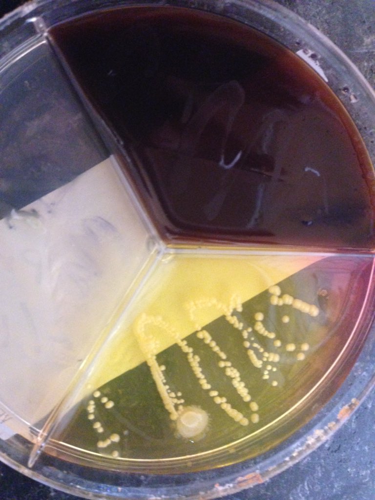 MeadowsFarmVets's tweet photo. Another successful #milksample #vetorapid #culture with a positive id of #staphaureus and #enterococci #teamdairy https://t.co/mGojVCWSHB