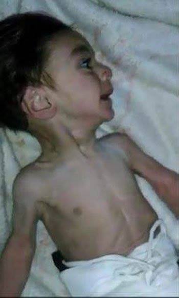 youm7's tweet image. #اليوم_السابع | بالصور والفيديو.. أطفال #مضايا بـ #سوريا يعانون من #الموت البطىء بسبب الجوع
goo.gl/cTlFvh