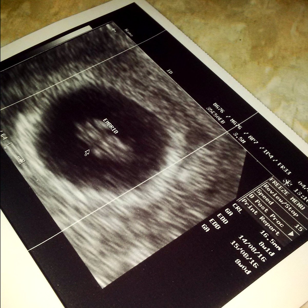 Thanks God.. Now waiting for 7 month to go... 🙏