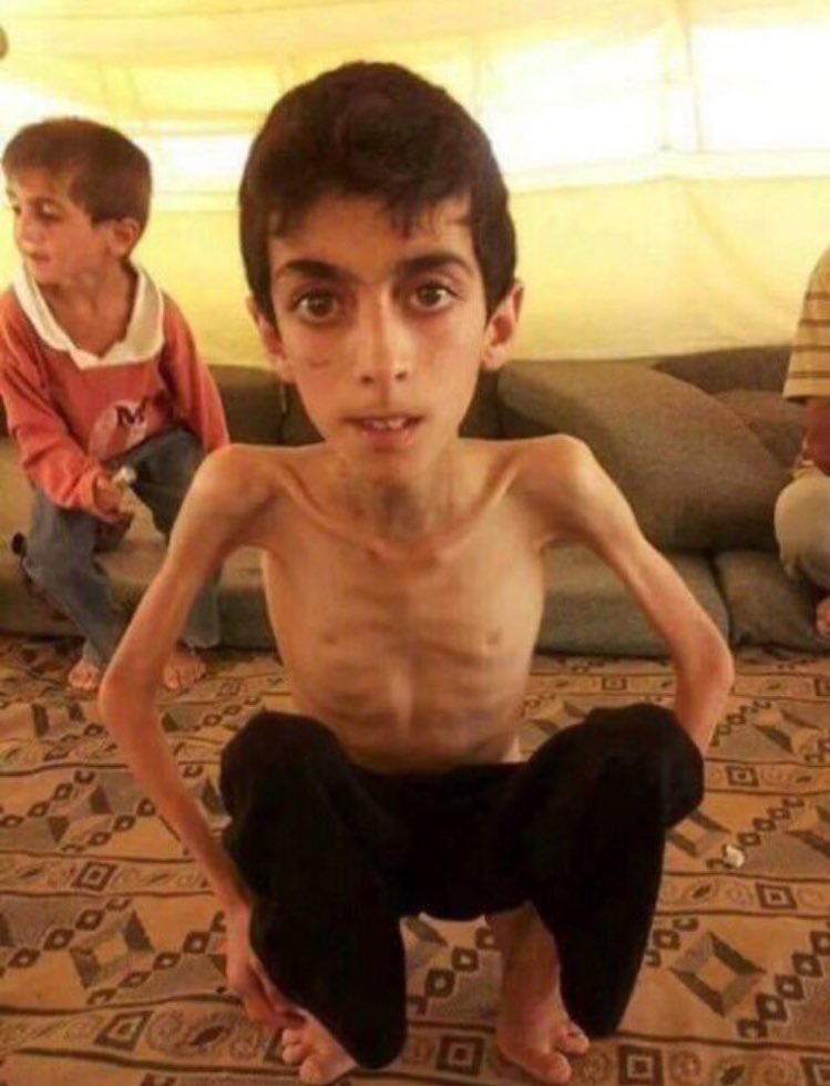 yasseraltwaijri's tweet photo. " لمثل هذا يذوب القلبُ من كمدٍ " ..
 يارب يارب فرج كربتهم .

#مضايا_تكسر_حصار_حزب_الله
#حصار_مضايا https://t.co/zGuPGb5V5M