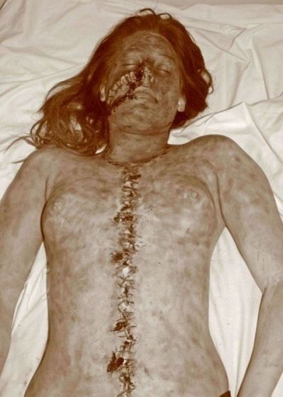 A photograph of one of my victims
(An real one. Quiet gruesome so don't look if you're squeamish)