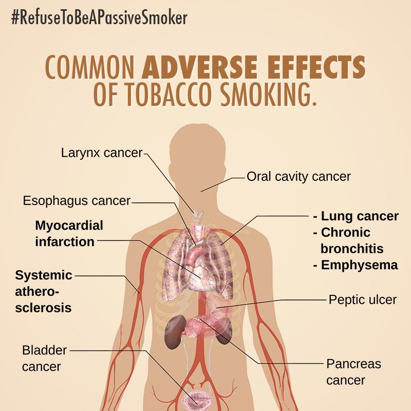 VitalStrat's tweet photo. Second-hand smoke causes 600,000 premature deaths per year. #SayNoToPassiveSmoking https://t.co/y9rAtXFlSU https://t.co/6TyNNmC4KI