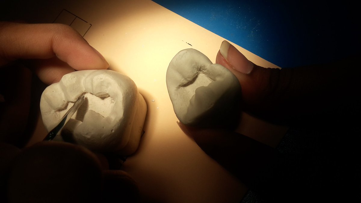 Dr_iqralaraib's tweet image. 1st cavity on plaster tooth 😃😃😃😃
#PhantomLab 😂😂