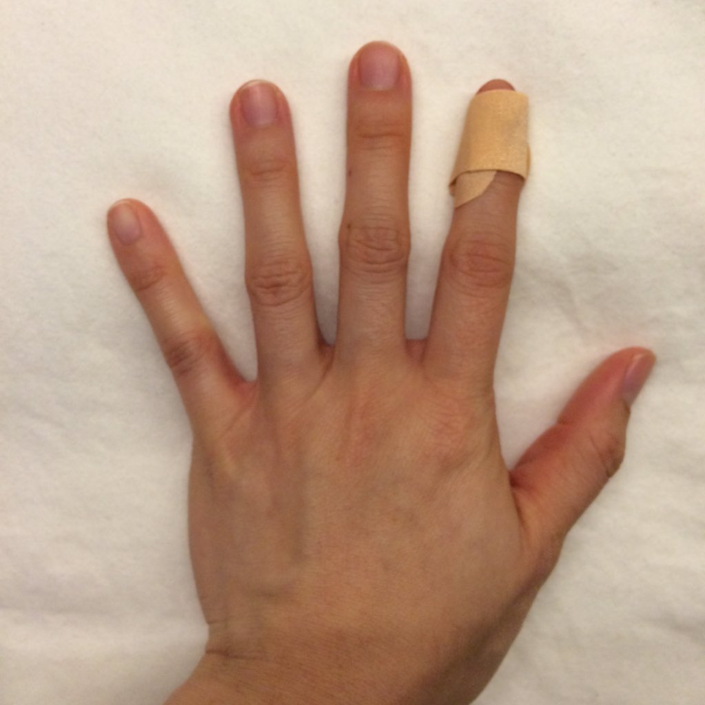 eirinikos's tweet photo. Cut my finger tonight... The blood loss reminded me of #DocMartin ... the bandaid reminded me of #MrsTishell... https://t.co/QxxO7zJYlz