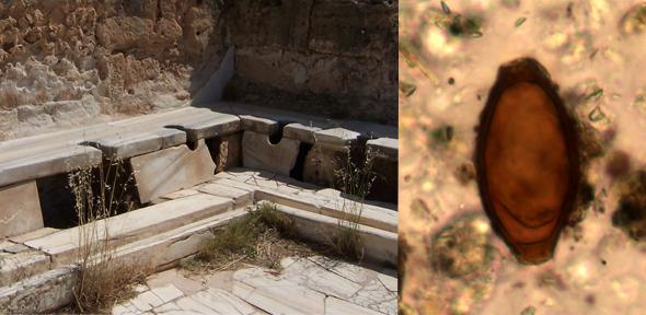 What did the Romans give us? Whipworm, that's what. cam.ac.uk/research/news/…