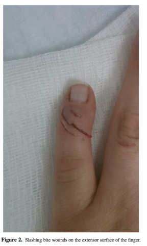 jr4science's tweet photo. #365paper (1) How not to train your dragon: a case of a komodo dragon bite #notvenomous https://t.co/1JqdN0Nwy8 https://t.co/GIdyjLyW37