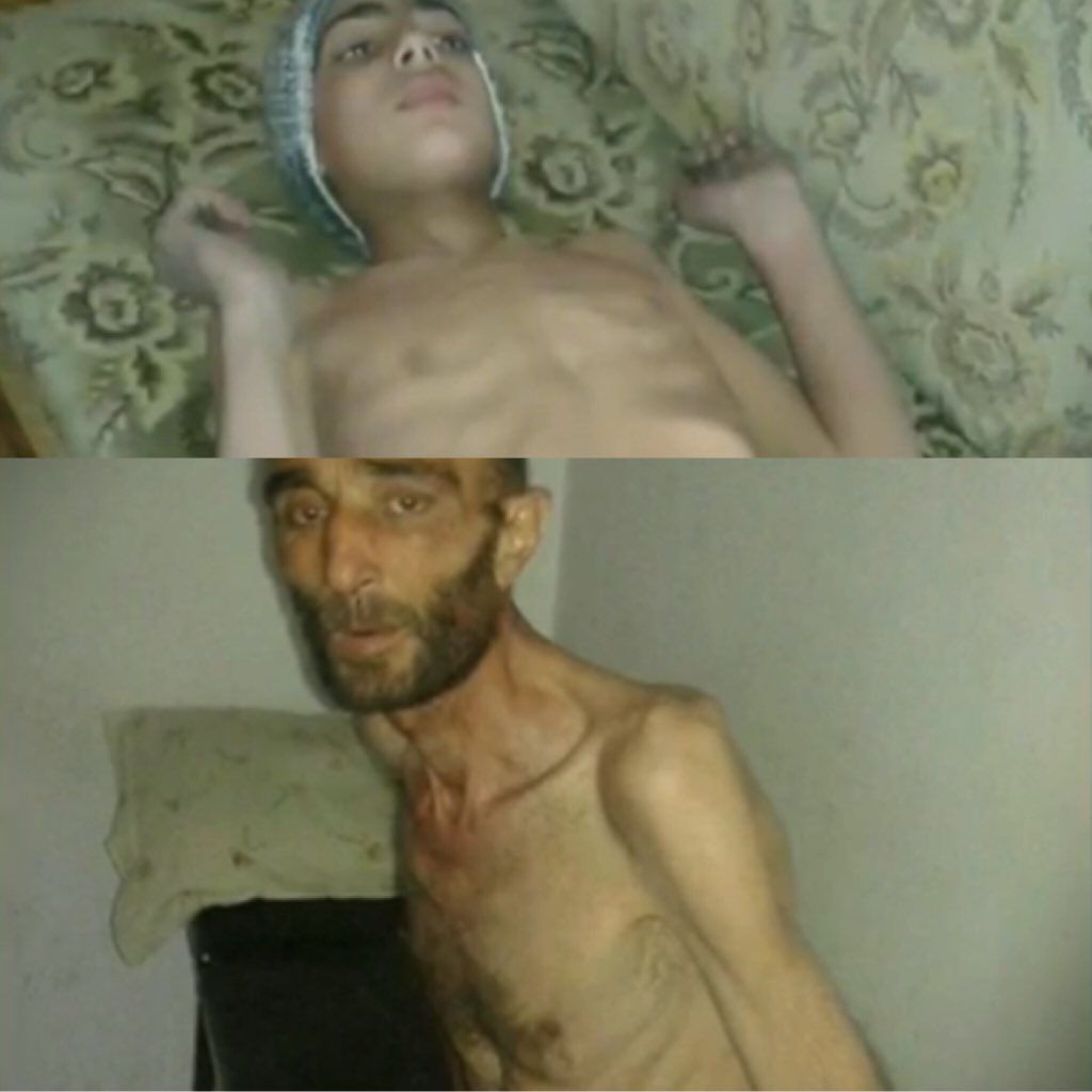 RichardEngel's tweet photo. Medic in starved #Madaya says people eating herbs in water with salt to survive, stray dogs and cats already eaten https://t.co/AA6BSRsRr4