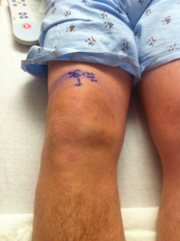 SummerStevens3's tweet photo. Hubby is getting knee surgery. #spinalblock #GiveHimDrugs https://t.co/ZiYjMiQDRB