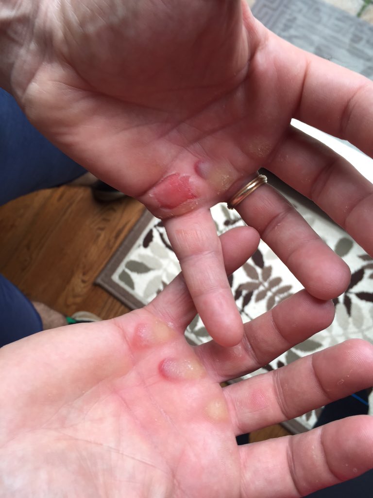 fitzstrength275's tweet photo. @AdelineGray sometimes you gotta show the bar who's boss.. #TrainForTheTitle https://t.co/0U33FFGkiM