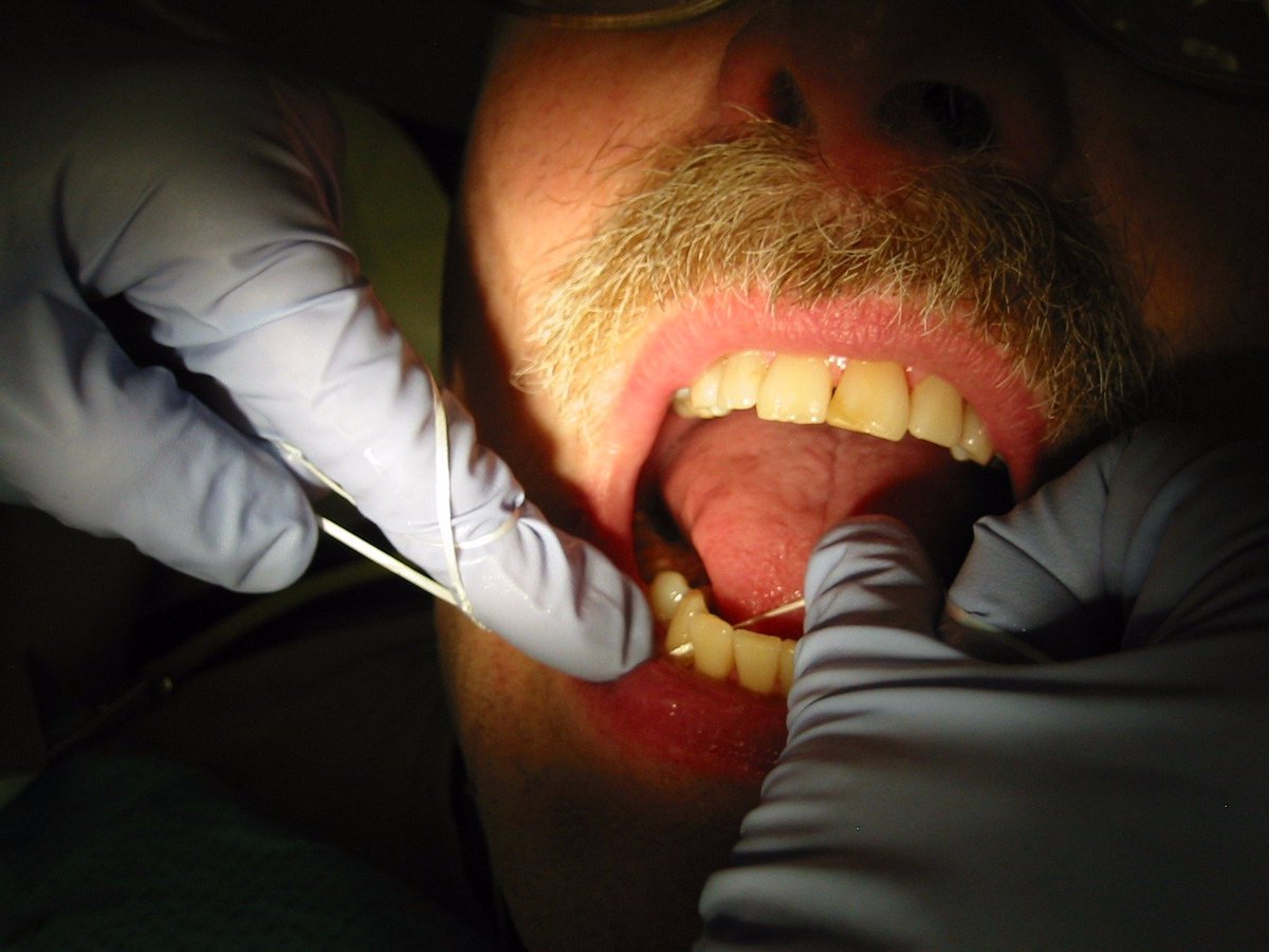 Are you #flossing enough? read.bi/1mJ0SsM