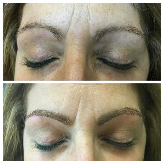 jilzy123's tweet photo. #picstitch #3Dbrows #browbuilding #browgrafting #perfectbrows #3Dbrowbuilding #browrecovery https://t.co/PH4t6v0w5B