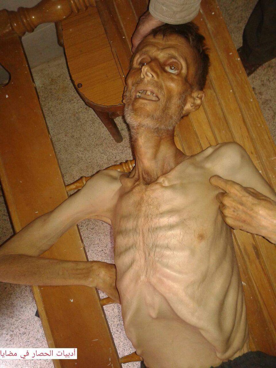 eliefares's tweet image. To The Lebanese &amp;amp; Arabs Mocking The Siege On Madaya And Its Starving People stateofmind13.com/2016/01/09/to-…