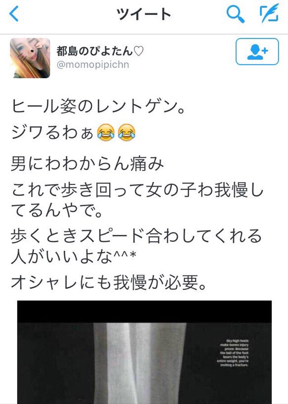だまれ。スニーカー履けや。