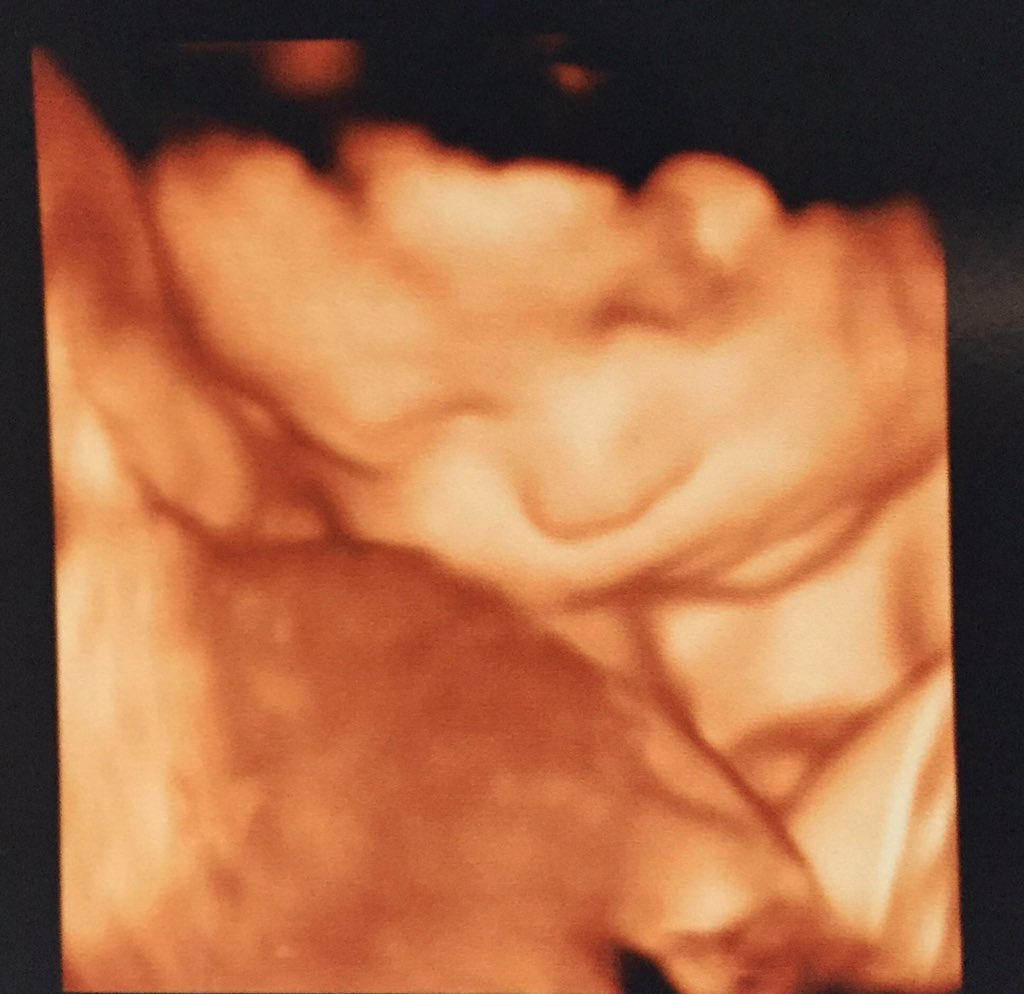 xoxogabrielaaa's tweet photo. I can't wait till he's here! Every picture looks the same but I still melt everytime😍 #LoganGray https://t.co/EETZ2ygOHZ
