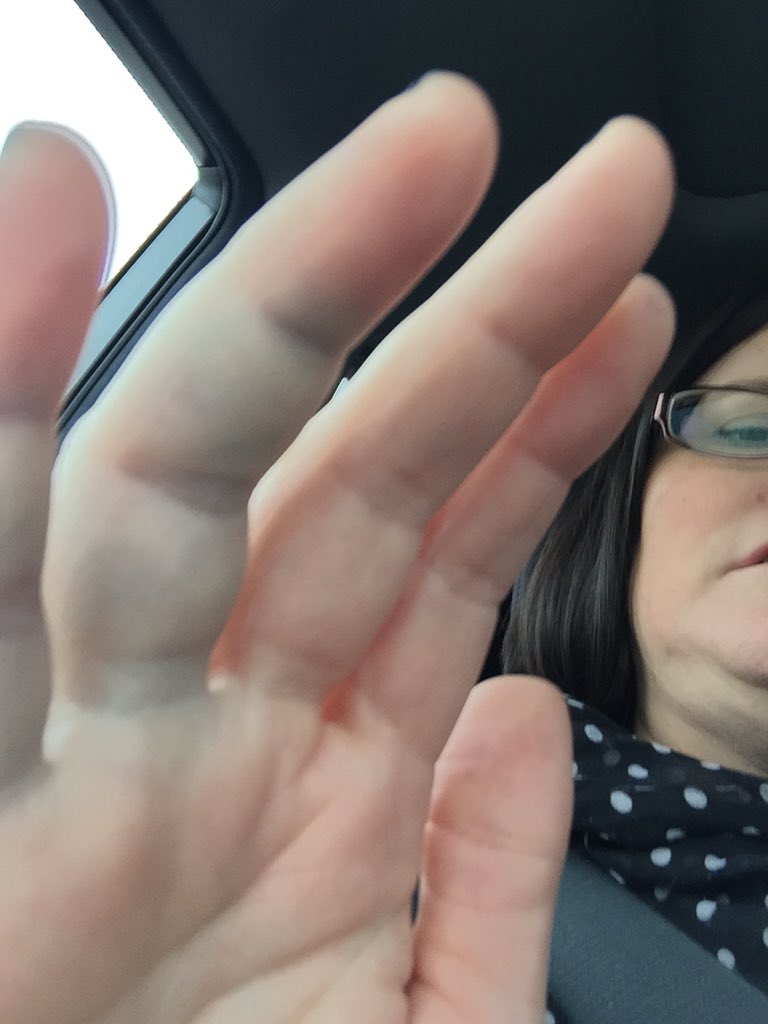 Basketball with your coworkers can be dangerous...