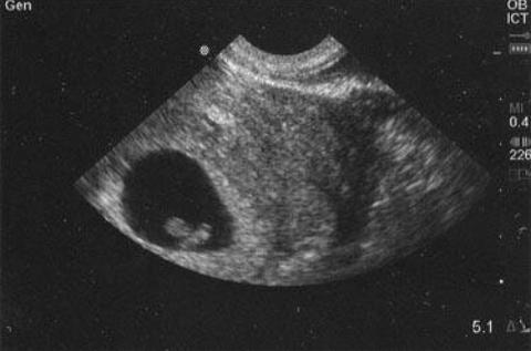 unborn baby (@brokenguitarr) on Twitter photo 