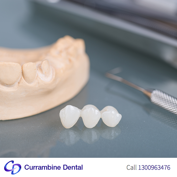 CURRAMDental's tweet photo. Improve or restore your smile with premium dental crowns and dental bridges. 
https://t.co/vaob4LC20U https://t.co/IyeLLhQDaA