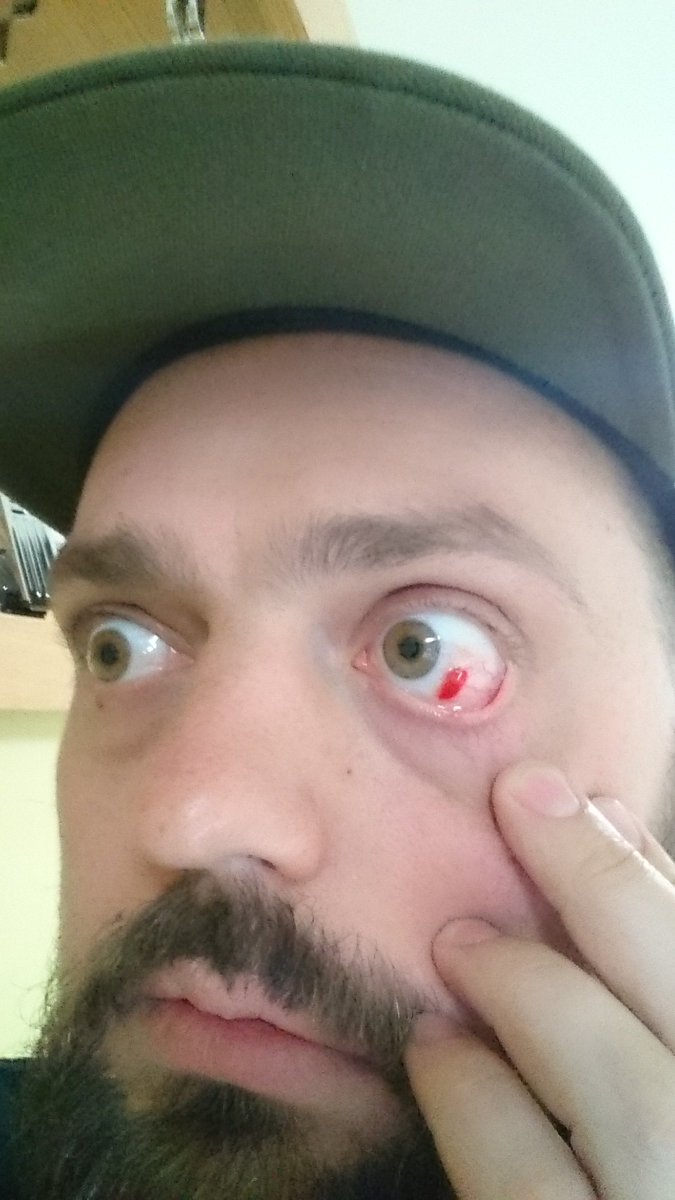 jonosteer's tweet photo. Too many red eye flights me thinks... https://t.co/bDHGhJVFBe