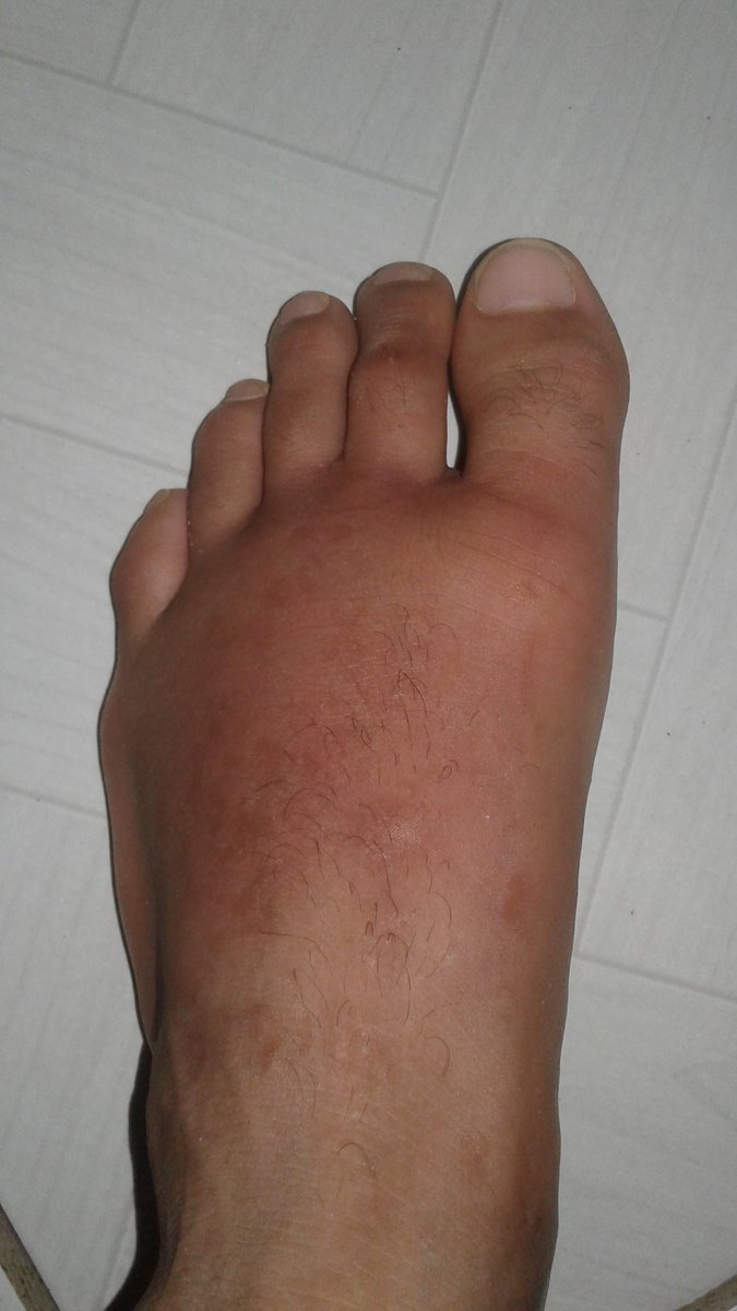 MrLookOfc's tweet photo. E assim que eu vou passar 2 semanas no gelo :/ https://t.co/bDiJQYyev4