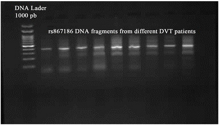 OALib_Journal's tweet photo. Relation between Endothelial #ProteinC Receptor Gene...Deep Vein #Thrombosis in Sudanese https://t.co/lbtHQywxdF https://t.co/ff4K7kz7BU