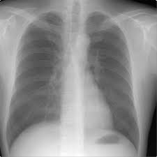 Fareastrandhos2's tweet photo. Radiographers use X-ray equipment to produce images that assist in the diagnosis of injuries and abnormalities. https://t.co/JurcIvbedQ