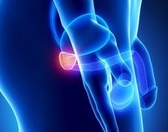 a_found_one's tweet photo. Cancer Facts
Not all treatments for prostate cancer cause side-effects

Read Thomas's Story

https://t.co/leLq0OGpko https://t.co/KCkVwqgYWh