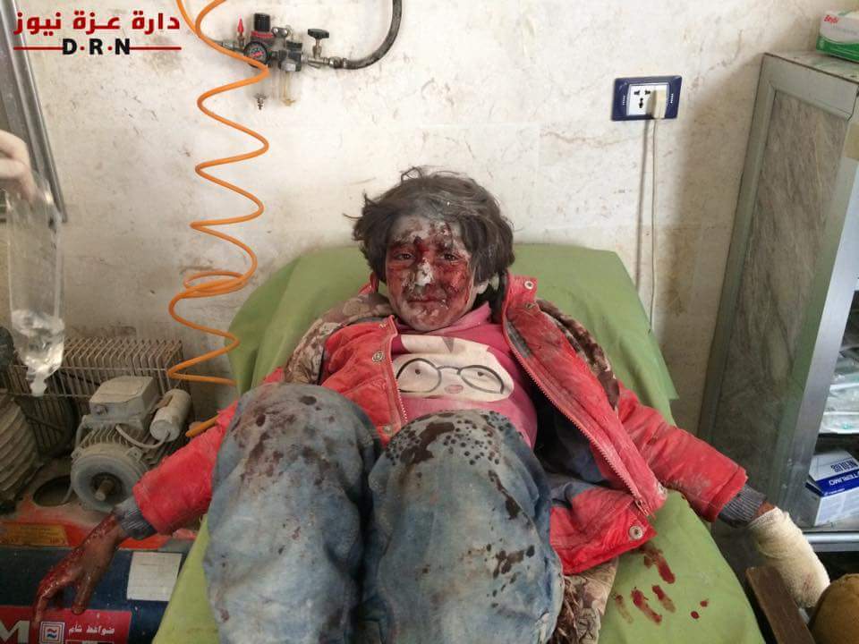 صور: بعض ضحايا القصف بالطائرات الحربية الروسية على مدرسة عين جارة بريف حلب !