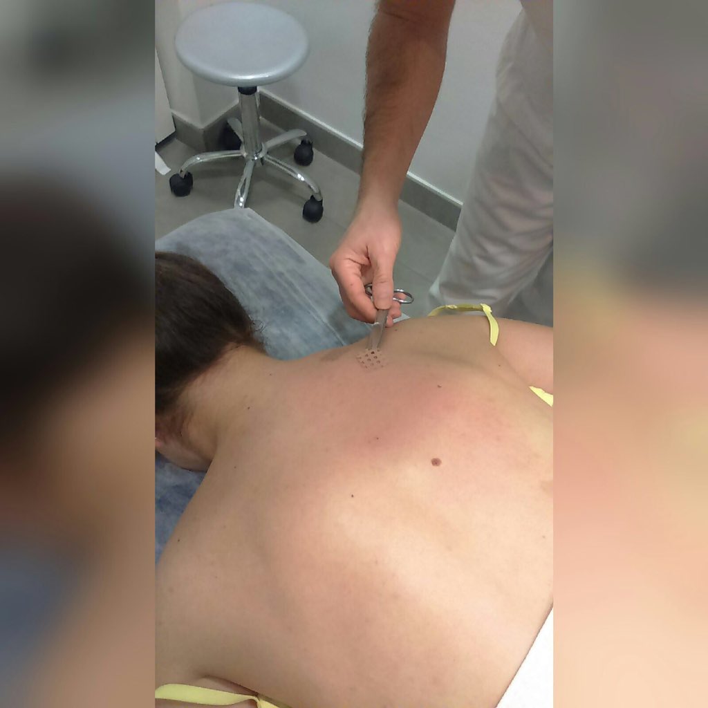 Puesta a punto de HCRT con los grandes profesionales de <a href="/CLINICAGLOBAL/">CLINICA GLOBAL</a> #humancycles #temporada2016