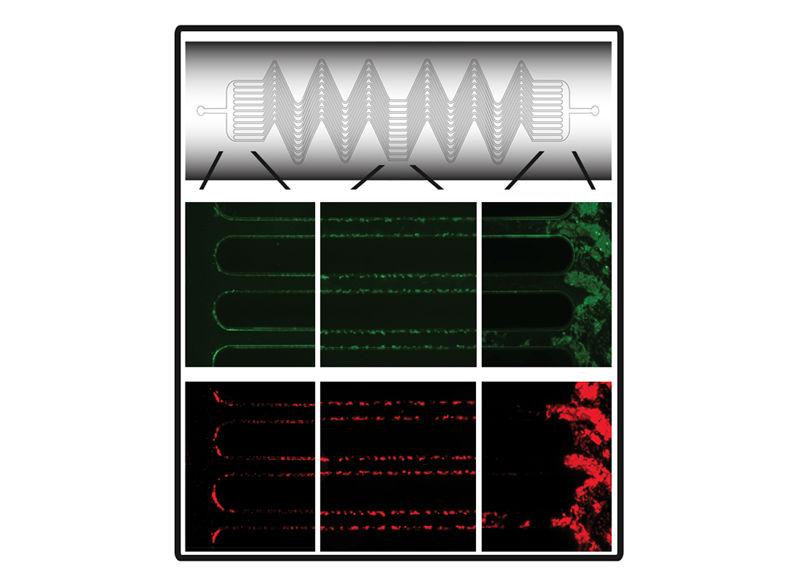 NovantaIMS's tweet image. Hemostasis Monitoring #Microdevice Detects Deadly Blood Clots &amp;gt; hubs.ly/H01PFk-0 via @MDTeditor #meddevice