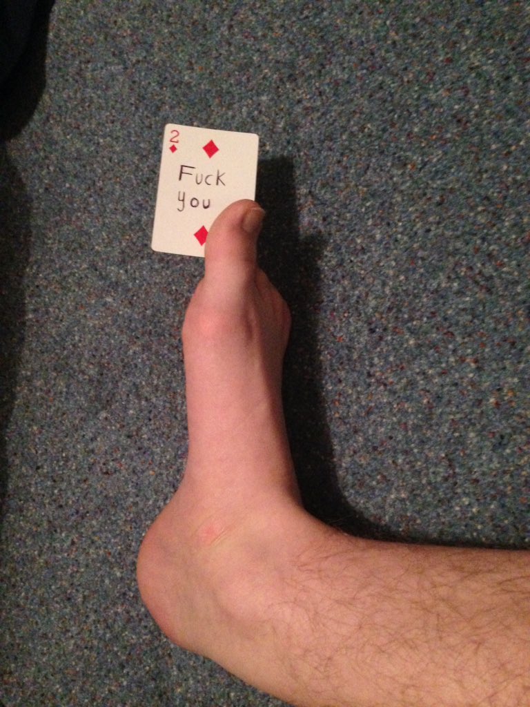 mylegdaily's tweet image. is this your card @nial0l