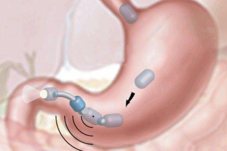 EngineeringRnD's tweet image. New advances In #BiomedicalRobotics in #2015: bit.ly/1mSfLbQ