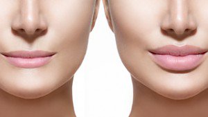 AbsoluteMedi's tweet photo. Pucker Up for #ValentinesDay! We are offering #Injectable #Fillers starting at $399 + tax beginning now until Feb 14 https://t.co/6PXrD1OECF
