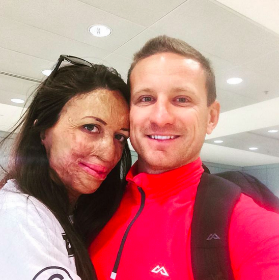 TURIA PITT REMINDS US THAT TRUE LOVE CAN OVERCOME ANY OBSTACLE =) bit.ly/1Op1lqE