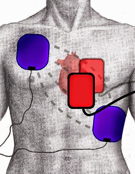 Anand Swaminathan MD MPH 🏳️🌈🇺🇦 tweet media