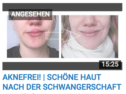 Filabe's tweet photo. Schönes Gefühl zu helfen @AnnesLeben #Aknefrei &amp; schöne Haut nach der #Schwangerschaft» – https://t.co/lcWESzN0Ko https://t.co/RURA27wIUf