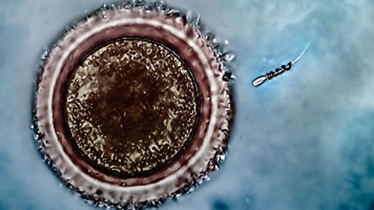 A novel idea for treating infertility: attach a small motor to the sperm scim.ag/1Q5VfjO (video)