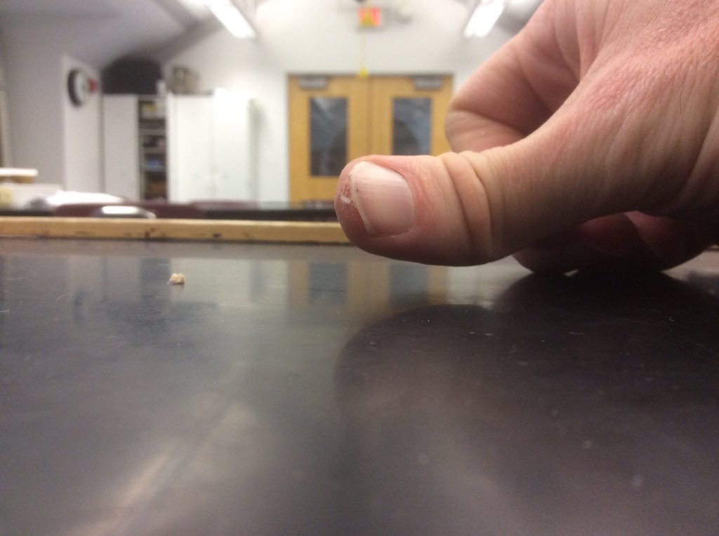 brmayer's tweet photo. Try not to glue skin to fingernail #BridgesofPDS https://t.co/XRB91PYmP3