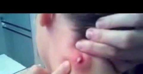 His Girlfriend Felt Something VERY STRANGE.. But When She Popped It.. OMG It Wouldn't Stop. bit.ly/1J4nbmJ