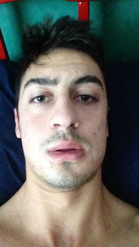 goodmoverock14's tweet photo. Ty says I'm top 2 ugliest in the house after my wisdom teeth surgery https://t.co/RI288h1bYN