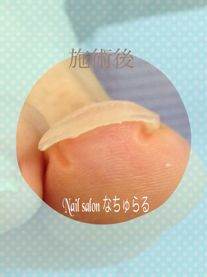 苫小牧ネイルサロン