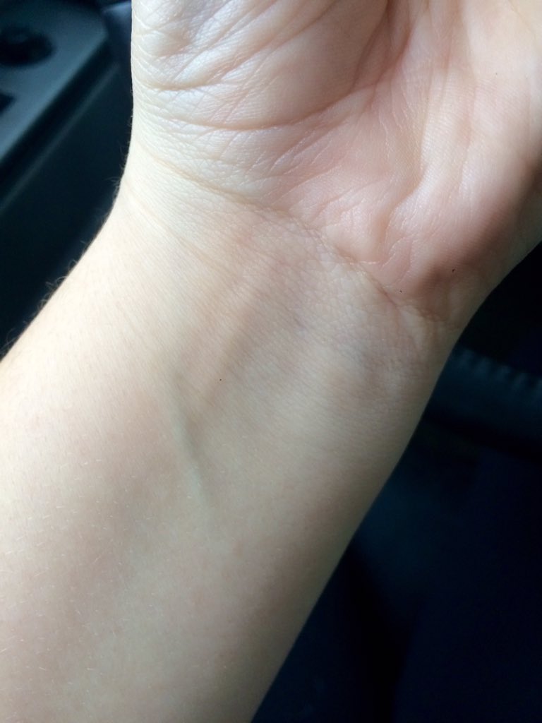 RouteToRipped's tweet image. starting to get vascular!! that means gains 💪🏼💞