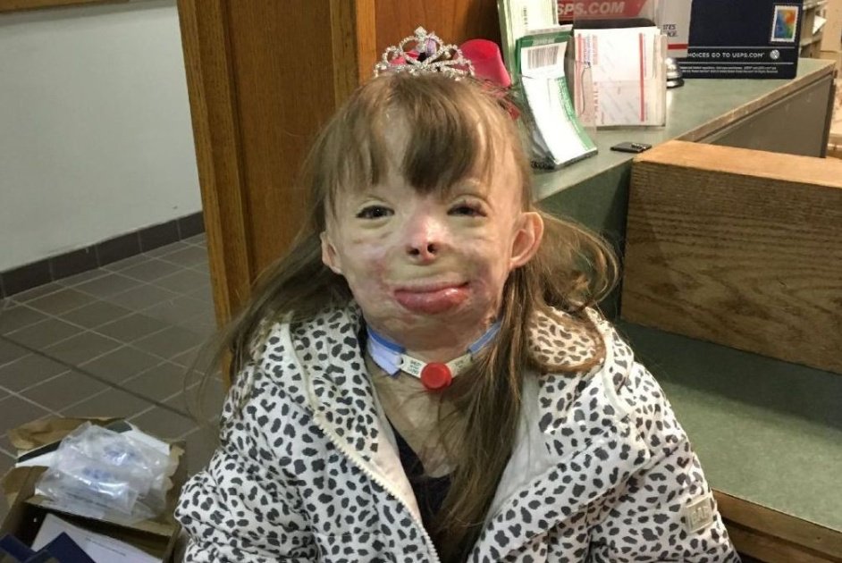 WCVB's tweet photo. Girl who lost family in fire asks for help opening 1.7M letters https://t.co/vIJJUtAgG4 https://t.co/8V01Pb5cum