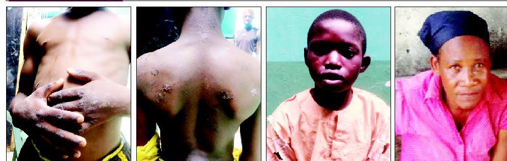 Guardian burns boy’s body with iron in Lagos . Wahala dey oo.