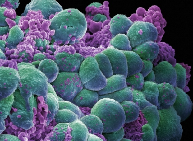 VICEUK's tweet image. We asked an expert: why haven&apos;t we cured cancer yet? bit.ly/1VtTexm